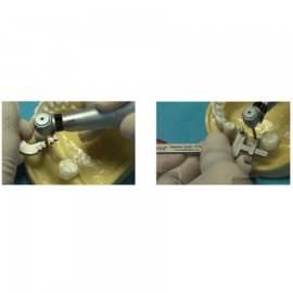 Implant Guide Kit