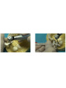Implant Guide Kit